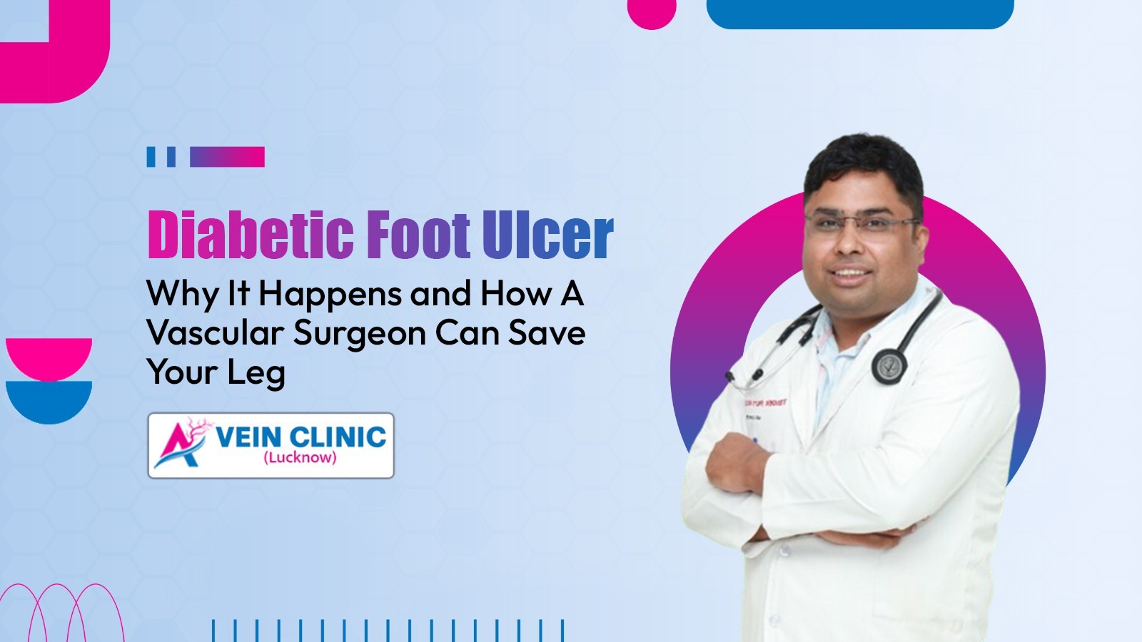 diabetic foot ulcer treatment in Lucknow
